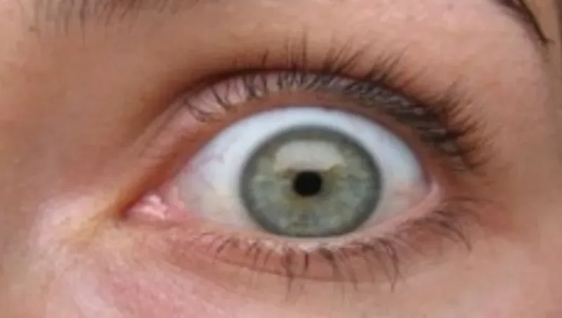 Un tío se masajeó los ojos con una pistola de percusión y acabó en urgencias con la retina hecha un Cristo